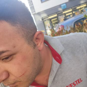 Teknik Servis Çalışanlarının Saldırısı Sonrası Maddi Ve Manevi Mağduriyet Yaşadım