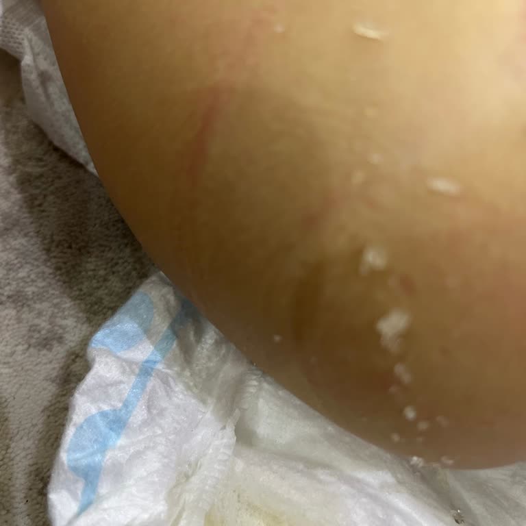 Molfix Bebek Bezinde Kristalleşme: Kızımın Sağlığı Tehlikede