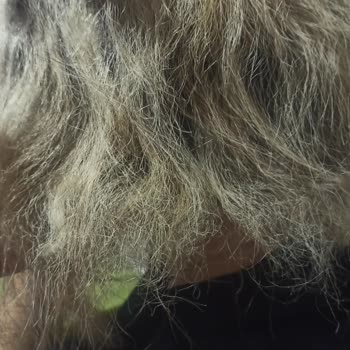 Kuaförde Yapılan Ombre İşlemi Sonrası Kızımın Saçında Ciddi Zarar Ve İlgisiz Yaklaşım