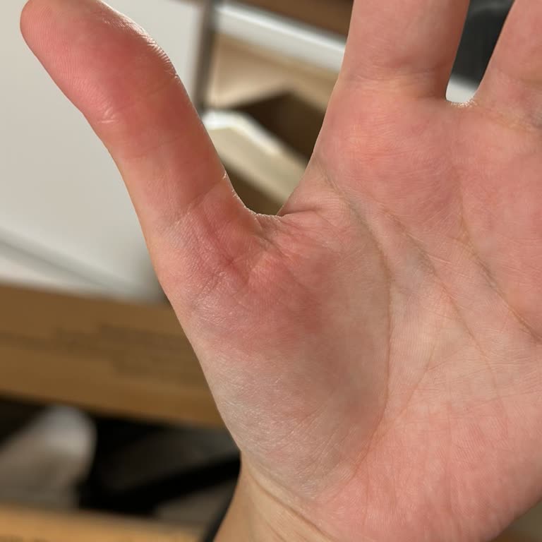 Garanti Kapsamındaki Buharlı Makinem Patladı, Çözüm Sunulmuyor Kısa Sürede Destek Bekliyorum