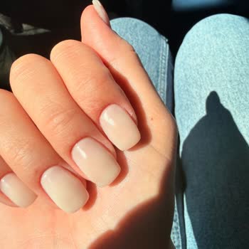 Protez Tırnak Sonrası Enfeksiyon Ve Kötü Uygulama Deneyimi