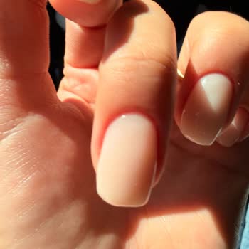 Protez Tırnak Sonrası Enfeksiyon Ve Kötü Uygulama Deneyimi