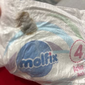 Üründe Karşılaşılan Sorun Ve İletişim Eksikliği