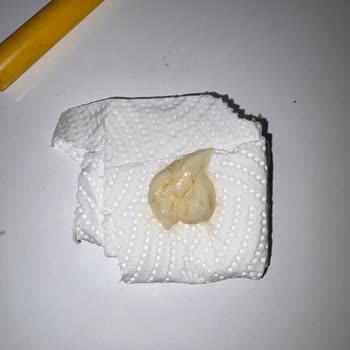 Migros Hemen Siparişimde Bozuk Ranch Sos Teslim Edildi