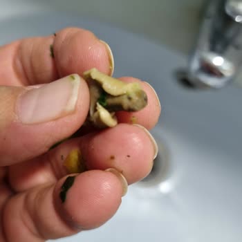 Dondurulmuş Ispanakta Salyangoz Çıktı, Bebeğimin Sağlığı Tehlikeye Girdi