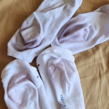 Ecco Mağazasından Alınan Ayakkabı Renk Veriyor, İade Talebim Reddedildi