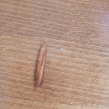 İkram Dondurma (Adana) Kahvede Tahta Parçası: Hayati Tehlike Ve Yetersiz Müdahale