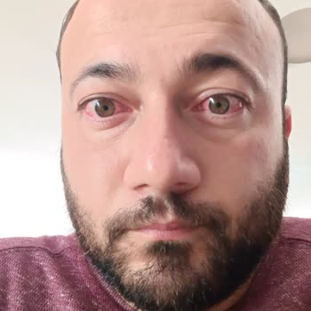 Göz Lazer Ameliyatı Sonrası Görme Sorunları Ve İlgisizlik