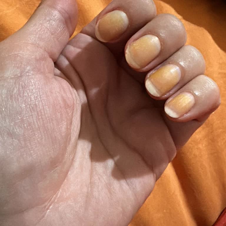 Flormar Oje Tırnaklarımda Kalıcı Sararma Yaptı