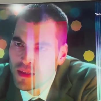 Philips TV Ekran Garantisi Kaç Yıl?