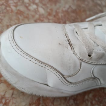 Kısa Sürede Yıpranan Ayakkabı Ve Tekrarlayan Sorunlar