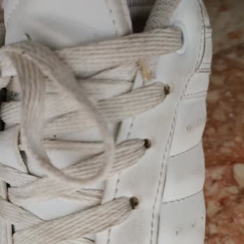 Kısa Sürede Yıpranan Ayakkabı Ve Tekrarlayan Sorunlar