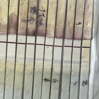 Gebelik Testlerinde Sürekli Yanlış Sonuç Ve Muhatap Bulamama Mağduriyeti