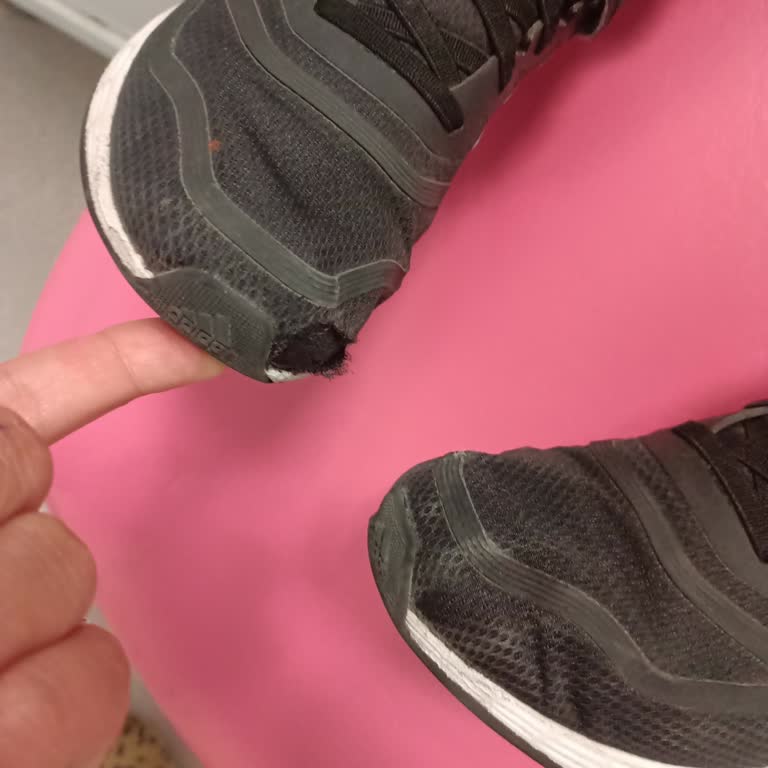 8 Kez Giydiğim Adidas Superstar Ayakkabıda Burun Yırtılması Yaşadım