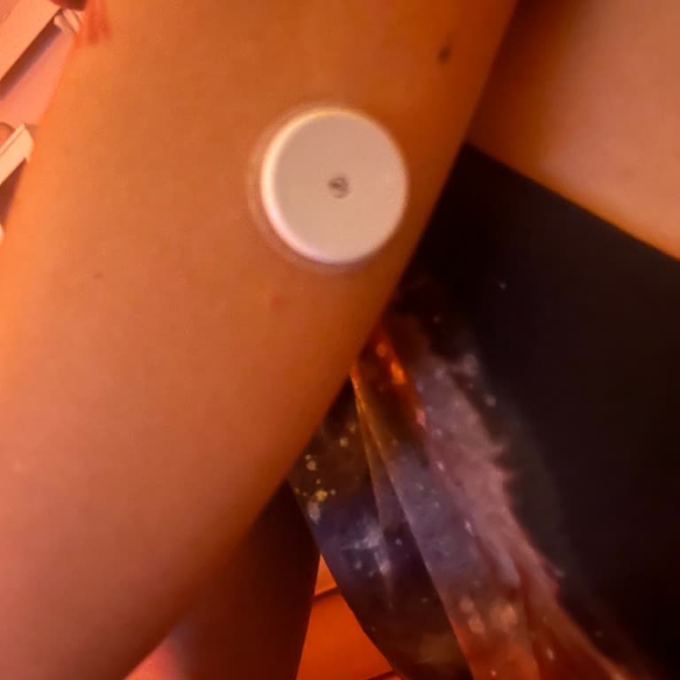 FreeStyle Libre 2 Sensor, problemas de señal y confianza tras compra