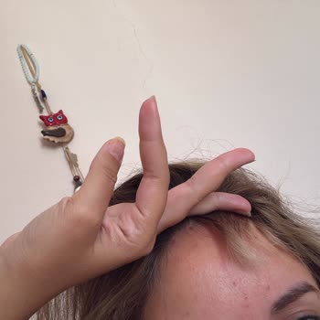 Saçım Yandı, 10.000 TL’lik İşlem Sonrası Mağdur Edildim!