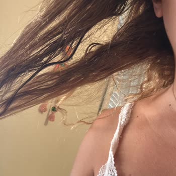 Saçım Yandı, 10.000 TL’lik İşlem Sonrası Mağdur Edildim!