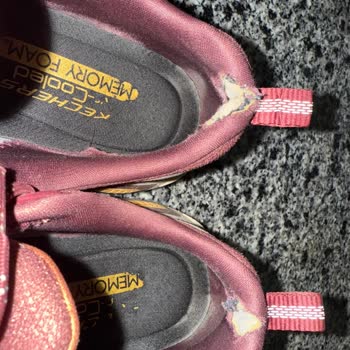 Skechers Ayakkabım Kısa Sürede Deforme Oldu Garanti Çözüm Sunmadı