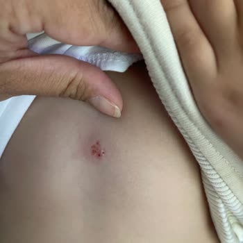 Anaokulunda Şiddet, İhmal Ve Maddi Mağduriyet