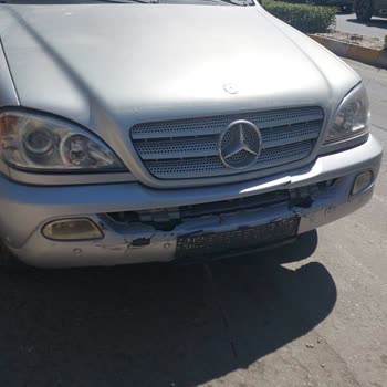 Kasko Poliçemde Parça Tedarik Edilemiyor, Mağdur Edildim