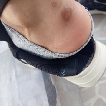 Yeni Alınan Ayakkabı Ayağımı Yaraladı, Değişim Talebim Reddedildi