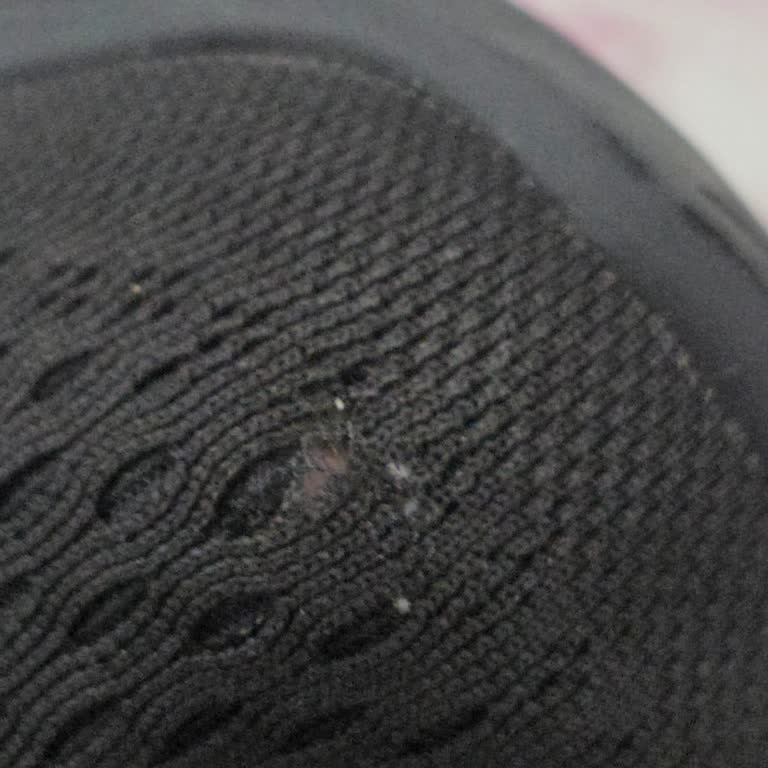 Skechers Ayakkabım 4 Ayda Deforme Oldu Garanti Çözüm Sunmadı