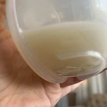 Göğüs Pompasında Sürekli Akıtma Problemi Ve Parça Talebi