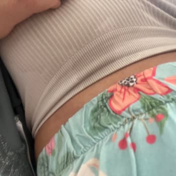 Göğüs Pompasında Sürekli Akıtma Problemi Ve Parça Talebi