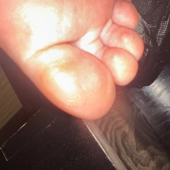 Yüksek Ücretli Kramponun Sürekli Rahatsızlık Vermesi Ve Başvuruların Reddedilmesi