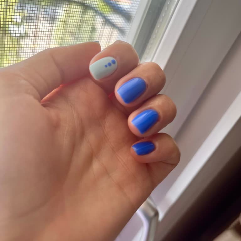 Manikür Sonrası Alerjik Reaksiyon Ve İlgisiz Hizmet Nedeniyle Mağduriyet