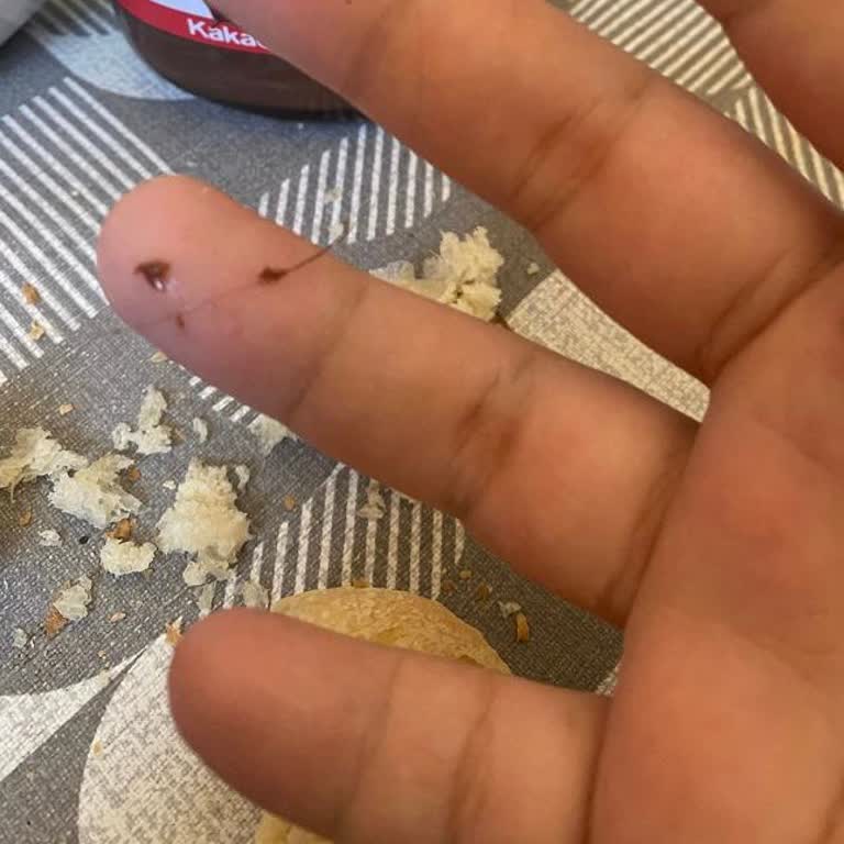 Aldığım Çikolatalardan Saç Ve Kirpik Çıktı: Hijyen Skandalı!