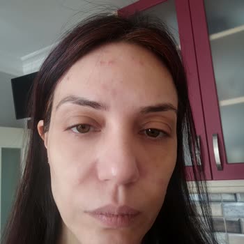 Darphin Hidratante y Protector Solar, problemas de acné en mi piel