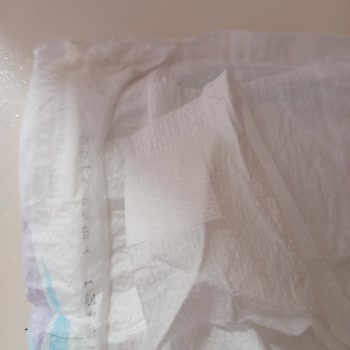 Molfix 6 Numara Bebek Bezinde Sert Şişlik Sorunu Ve Ürün Değişim Talebi