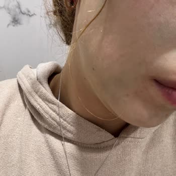 Kil Maskesi Cildimde Kalıcı Yeşil İz Bıraktı Çözüm Bekliyorum