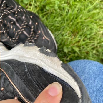 Ayakkabıda Açılma Ve Rahatsızlık Sorunu, İade Talebinin Reddi Ve Belge Eksikliği