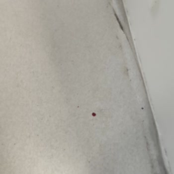 Hastane Odasında Hijyen Eksikliği Ve Personel İlgisizliği