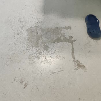 Hastane Odasında Hijyen Eksikliği Ve Personel İlgisizliği