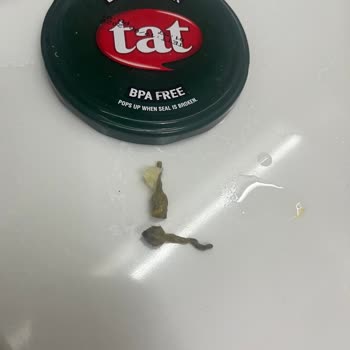 Tat Karışık Garnitürde Yabancı Cisim Şoku