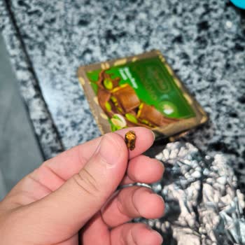 Torku Antep Fıstıklı Çikolatadan Fıstık Yerine Odun Parçası Çıkması Ve Diş Kırılması