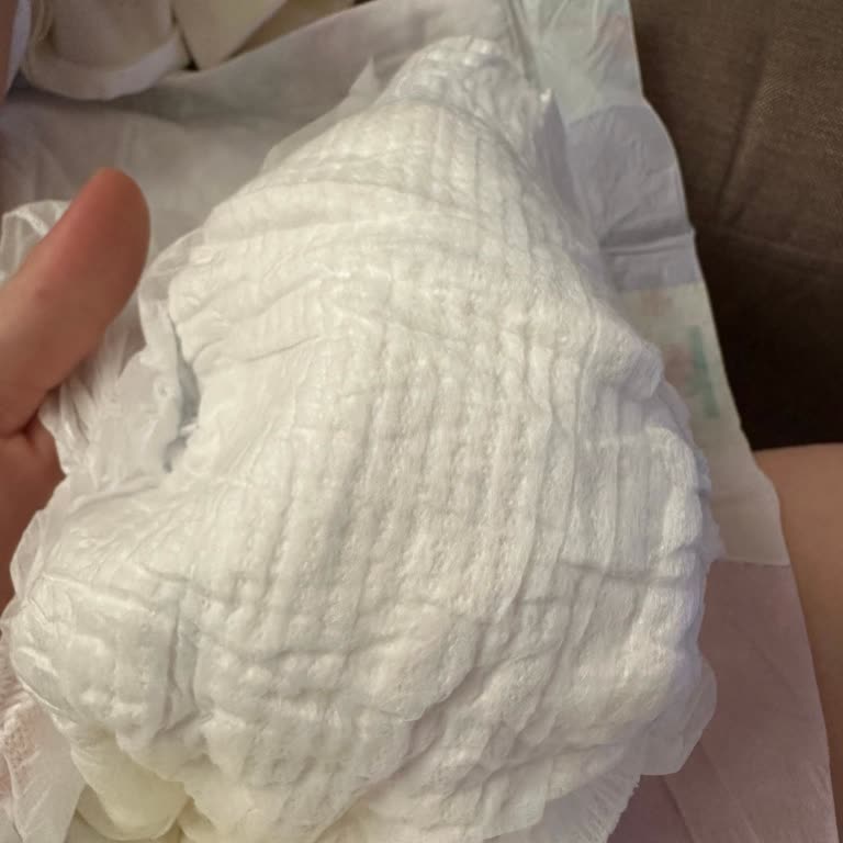 Molfix Bebek Bezi Ciltte İz Bırakıyor, Sürekli Tekrar Eden Sorun