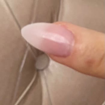 Aceleyle Yapılan Protez Tırnak Uygulaması Ve İlgisiz Hizmet Sonrası Mağduriyet