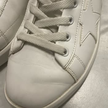 Kısa Sürede Renk Değişimi Yaşayan Ayakkabım İçin Çözüm Bekliyorum