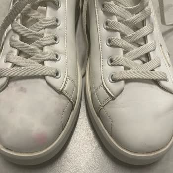 Kısa Sürede Renk Değişimi Yaşayan Ayakkabım İçin Çözüm Bekliyorum