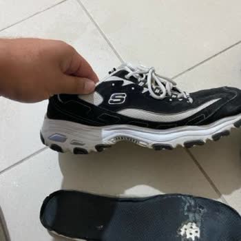 Kısa Sürede Deforme Olan Ayakkabıma İade Talebim Reddedildi