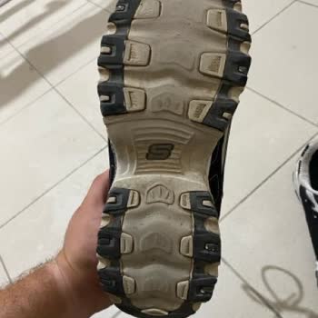 Kısa Sürede Deforme Olan Ayakkabıma İade Talebim Reddedildi