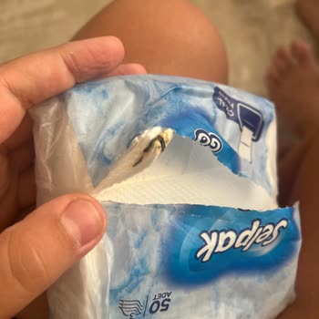 Selpak GO Havlu Paketinde Kuş Dışkısı Buldum, Mağduriyetimin Giderilmesini İstiyorum