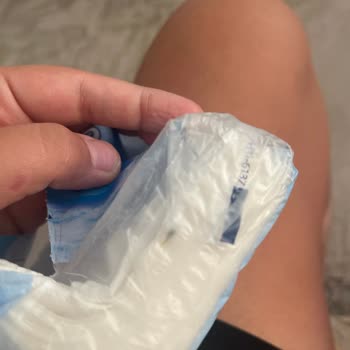 Selpak GO Havlu Paketinde Kuş Dışkısı Buldum, Mağduriyetimin Giderilmesini İstiyorum