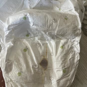 Bebek Bezinde Sert Cisimle Karşılaşmam Güvenimi Sarsıldı