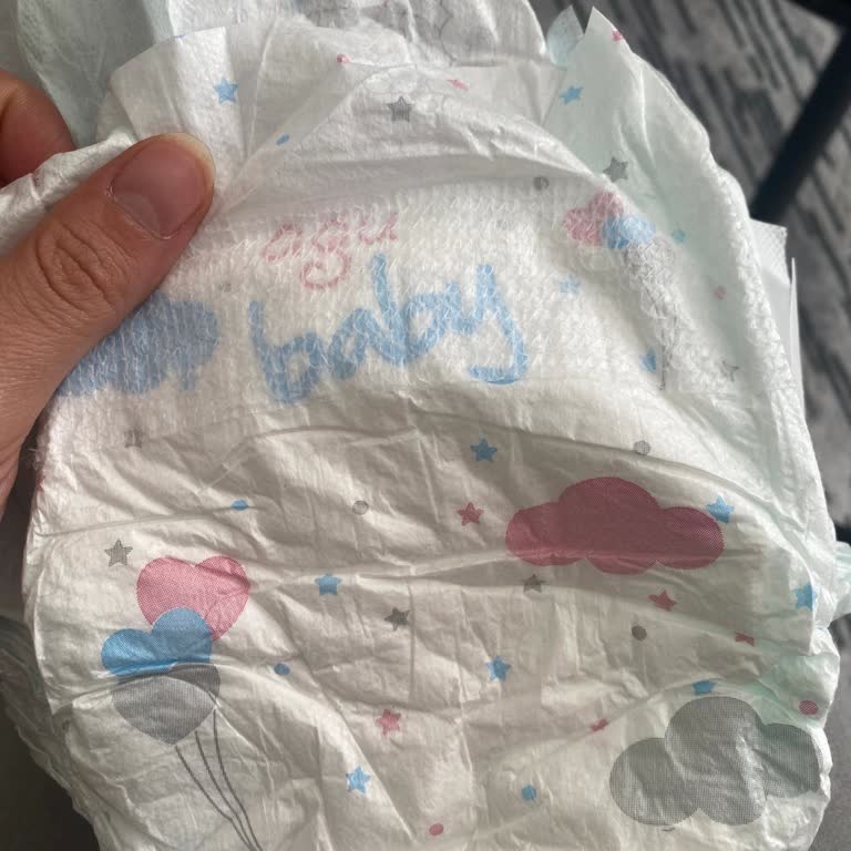 Agu Baby Bebek Bezinde Ani Sızdırma Sorunu Ve Müşteri Hizmetlerine Ulaşamama