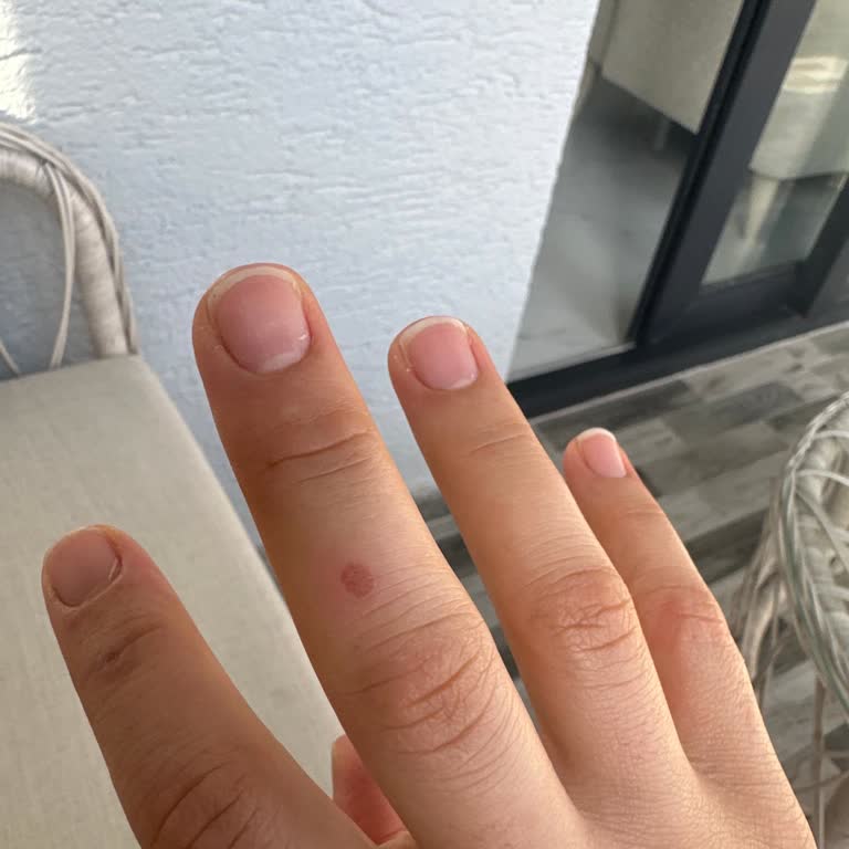 Jumbo Paslanmaz Çelik Çaydanlıkta Güvenlik Sorunu Ve Yanık Riski